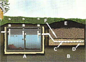 Typical septic diagram