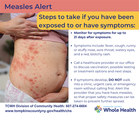steps to take if exposed to measles: call healthcare provider or our office 607-274-6604